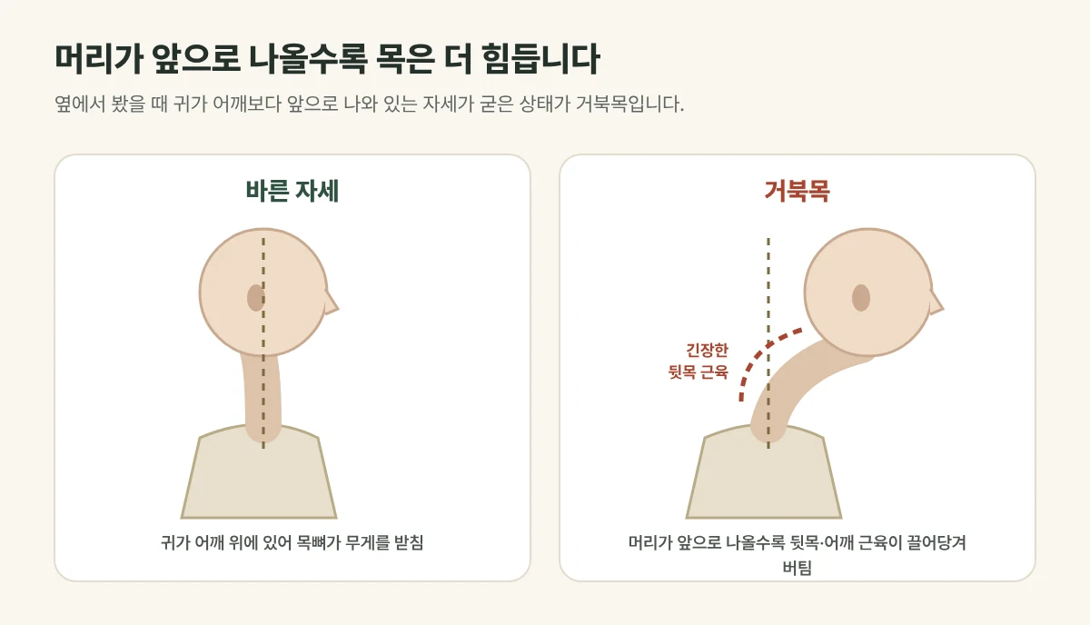 바른 자세와 거북목 비교 그림: 머리가 어깨보다 앞으로 나오면 뒷목과 어깨 근육이 버텨야 하는 부담이 커짐