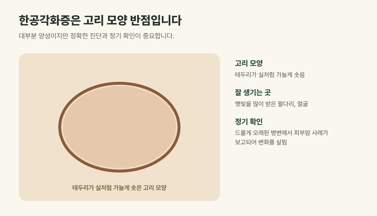 한공각화증 그림: 테두리가 실처럼 가늘게 솟은 고리 모양 반점